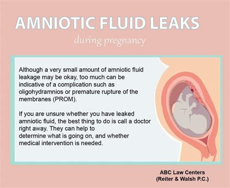 treatment for leaking amniotic fluid|Amniotic Fluid Problems/Hydramnios/Oligohydramnios